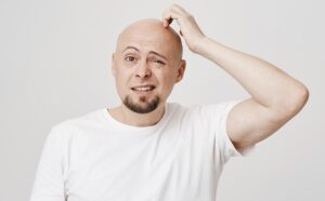 What Are the Reasons, Signs, And Treatment of Baldness?