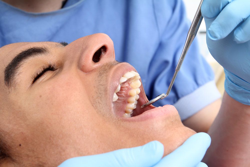 How Do Dentists Remove A Tooth Nerve in Severe Dental Pain?