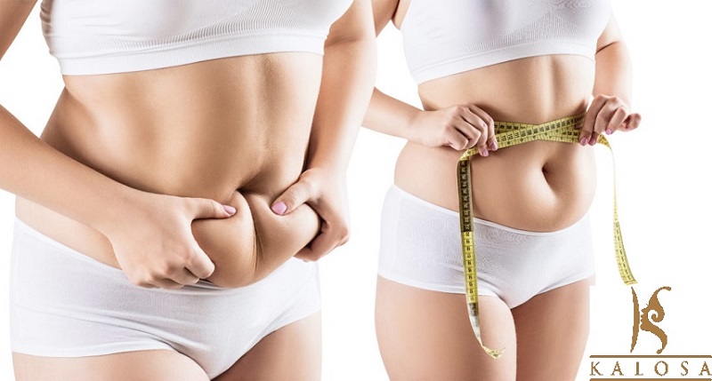 The Amazing Benefits of Liposuction Surgery in Fat Reduction